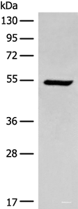 Western blot analysis of HEPG2 cell lysate using ACD Polyclonal Antibody at dilution of 1:400
