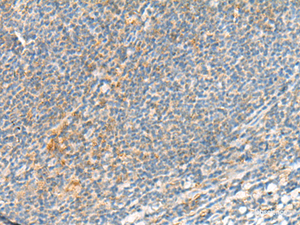 Immunohistochemistry of paraffin-embedded Human tonsil tissue using TSHB Polyclonal Antibody at dilution of 1:95 (×200)