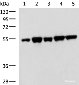 Western blot analysis of PC3 K562 HepG2 Hela A172 cell lysates using FKBP5 Polyclonal Antibody at dilution of 1:600