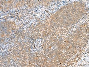 Immunohistochemistry of paraffin-embedded Human tonsil tissue using FOLR1 Polyclonal Antibody at dilution of 1:80 (×200)