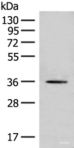 Western blot analysis of Hela cell lysate using MLST8 Polyclonal Antibody at dilution of 1:500