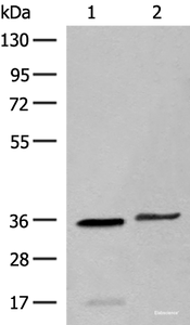 Western blot analysis of Human sigmoid tissue and HT-29 cell lysates using LGALS4 Polyclonal Antibody at dilution of 1:400