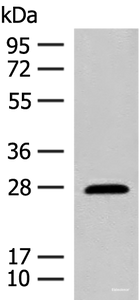 Western blot analysis of Mouse eye tissue lysate using GUCA1B Polyclonal Antibody at dilution of 1:500