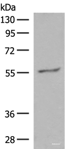 Western blot analysis of Hela cell lysate using GPR161 Polyclonal Antibody at dilution of 1:500