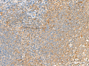 Immunohistochemistry of paraffin-embedded Human tonsil tissue using GRIK2 Polyclonal Antibody at dilution of 1:55 (×200)