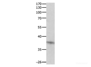 Western Blot analysis of Jurkat cell using DUSP12 Polyclonal Antibody at dilution of 1:500