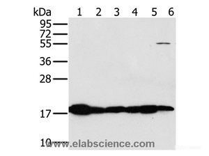 Western Blot analysis of Mouse heart and muscle tissue, hela cell and Mouse liver tissue, Mouse kidney tissue and hepg2 cell using MTFP1 Polyclonal Antibody at dilution of 1:450