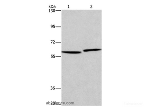 Western Blot analysis of Human testis and prostate tissue using HAS1 Polyclonal Antibody at dilution of 1:350