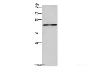 Western Blot analysis of Mouse heart tissue using IL5RA Polyclonal Antibody at dilution of 1:550