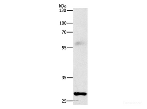 Western Blot analysis of Mouse lung tissue using FGF2 Polyclonal Antibody at dilution of 1:1000