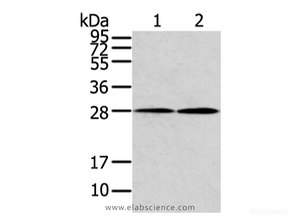 Western Blot analysis of Mouse heart and lung tissue using KCNMB1 Polyclonal Antibody at dilution of 1/500