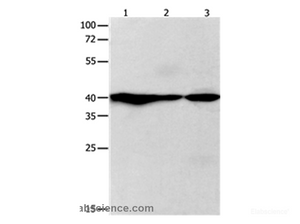 Western Blot analysis of Human fetal brain and brain malignant glioma, Mouse brain tissue using GNAZ Polyclonal Antibody at dilution of 1:400