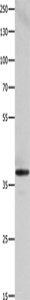 Western blot analysis of HepG2 cells using HMOX2 Polyclonal Antibody at dilution of 1:500