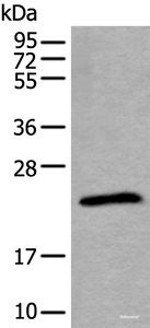 Western blot analysis of Jurkat cell lysate using TPT1 Polyclonal Antibody at dilution of 1:800