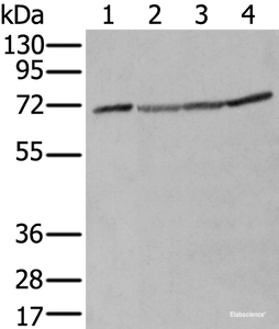 Western blot analysis of A172 Hela Hepg2 and K562 cell lysates using ZUFSP Polyclonal Antibody at dilution of 1:300