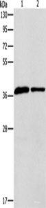 Western blot analysis of Human fetal liver tissue huvec cells using APOL2 Polyclonal Antibody at dilution of 1:725