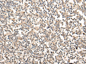 Immunohistochemistry of paraffin-embedded Human tonsil tissue using MAGEA1 Polyclonal Antibody at dilution of 1:65 (×200)