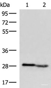 Western blot analysis of Human fetal intestines tissue and Human fetal liver tissue lysates using KLRB1 Polyclonal Antibody at dilution of 1:800