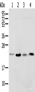 Western blot analysis of Rat lung tissue HT-29 cell Mouse adrenal gland tissue and K-562 cell using SPCS2 Polyclonal Antibody at dilution of 1:450