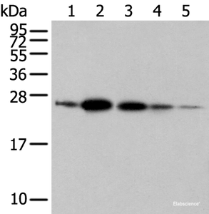 Western blot analysis of 293T A549 and 231 cell Human fetal brain tissue Human placenta tissue using RAB11A Polyclonal Antibody at dilution of 1:500