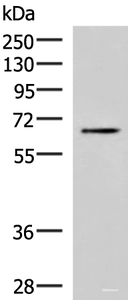 Western blot analysis of Jurkat cell lysate using BRD9 Polyclonal Antibody at dilution of 1:800