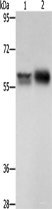 Western blot analysis of Hepg2 cells NIH/3T3 cells using ZBTB7A Polyclonal Antibody at dilution of 1:500