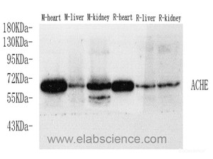 Western Blot analysis of various samples using ACHE Polyclonal Antibody at dilution of 1:750.