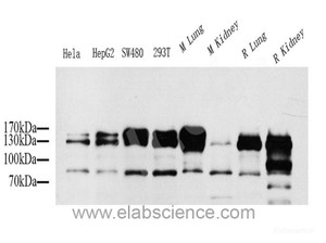 Western Blot analysis of various samples using CD31 Polyclonal Antibody at dilution of 1:1000.