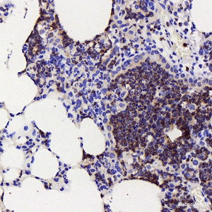 Immunohistochemistry analysis of paraffin-embedded mouse pneumonia using COX2 Polyclonal Antibody at dilution of 1:500.