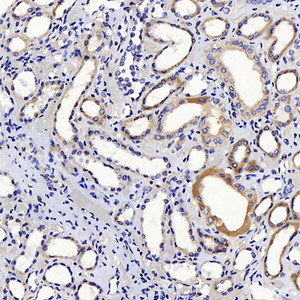 Immunohistochemistry analysis of paraffin-embedded human kidney using CTGF Polyclonal Antibody at dilution of 1:100.