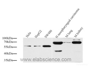 Western Blot analysis of various samples using CD54 Polyclonal Antibody at dilution of 1:1000.