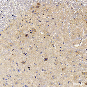 Immunohistochemistry analysis of paraffin-embedded mouse spinal marrow using NOS2 Polyclonal Antibody at dilution of 1:500.