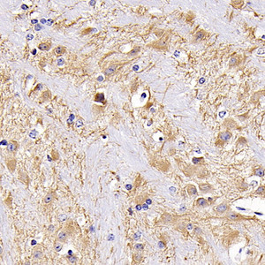 Immunohistochemistry analysis of paraffin-embedded mouse brain using MAP2 Polyclonal Antibody at dilution of 1:300.