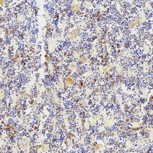 Immunohistochemistry analysis of paraffin-embedded mouse bone using TNFRSF11B Polyclonal Antibody at dilution of 1:200.