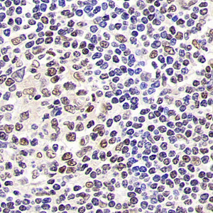 Immunohistochemistry analysis of paraffin-embedded human tonsil using SIRT1 Polyclonal Antibody at dilution of 1:500.