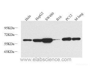 Western Blot analysis of various samples using Vimentin Polyclonal Antibody at dilution of 1:1000.