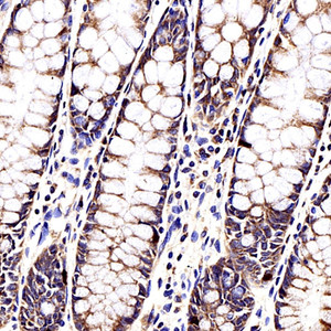 Immunohistochemistry analysis of paraffin-embedded human colon using CCL2 Polyclonal Antibody at dilution of 1:500.