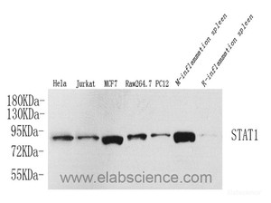 Western Blot analysis of various samples using STAT1 Polyclonal Antibody at dilution of 1:1000.