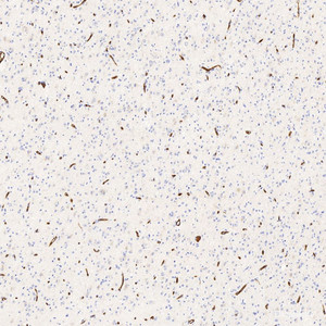 Immunohistochemistry analysis of paraffin-embedded human brain using GLUT-1 Polyclonal Antibody at dilution of 1:300.