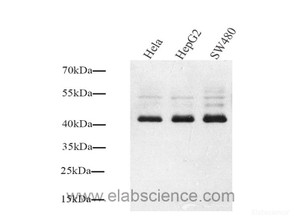 Western Blot analysis of various samples using Connexin 43 Polyclonal Antibody at dilution of 1:1000.