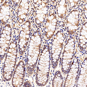 Immunohistochemistry analysis of paraffin-embedded human colon tissue using Galectin 3 Polyclonal Antibody at dilution of 1:300.