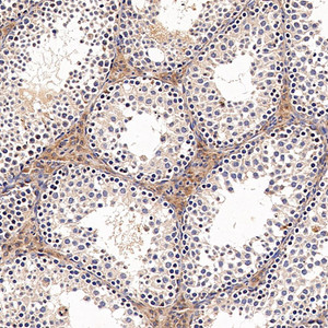 Immunohistochemistry analysis of paraffin-embedded Rat testis using ACE1 Polyclonal Antibody at dilution of 1:300.