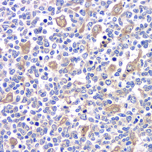 Immunohistochemistry analysis of paraffin-embedded human tonsil using TLR9 Polyclonal Antibody at dilution of 1:200.