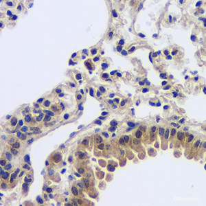Immunohistochemistry analysis of paraffin-embedded mouse lung using MYD88 Polyclonal Antibody at dilution of 1:200.