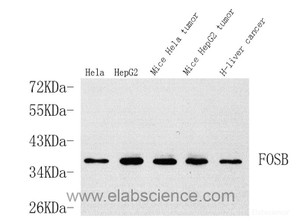 Western Blot analysis of various samples using FOSB Polyclonal Antibody at dilution of 1:1000.