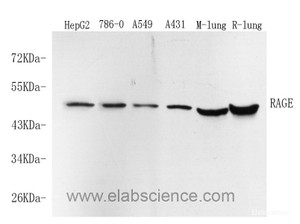 Western Blot analysis of various samples using RAGE Polyclonal Antibody at dilution of 1:750.