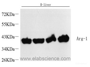 Western Blot analysis of various samples using ARG1 Polyclonal Antibody at dilution of 1:10000.