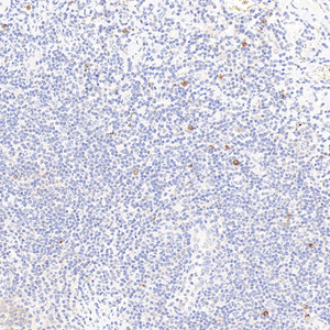 Immunohistochemistry analysis of paraffin-embedded Human tonsil using NLRP3 Polyclonal Antibody at dilution of 1:400.