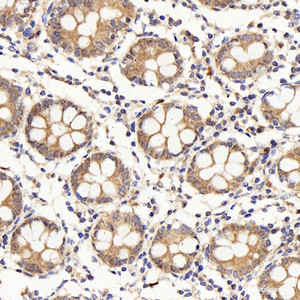 Immunohistochemistry analysis of paraffin-embedded human colon using IL22RA1 Polyclonal Antibody at dilution of 1:200.