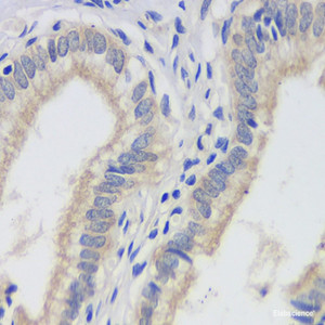 Immunohistochemistry analysis of paraffin-embedded human gallbladder using FAS Monoclonal Antibody at dilution of 1:200.